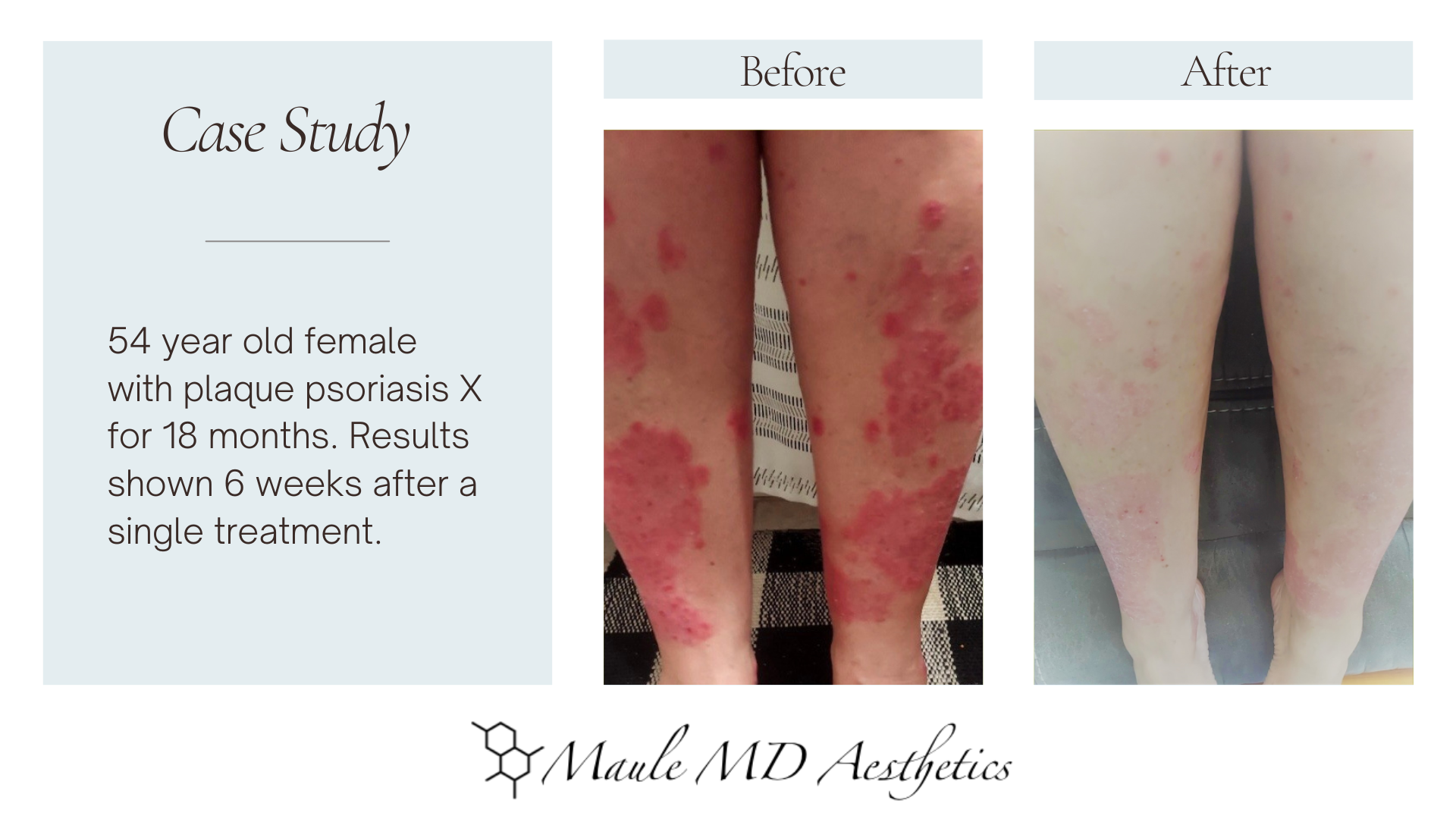 Regenerative Skin Treatment