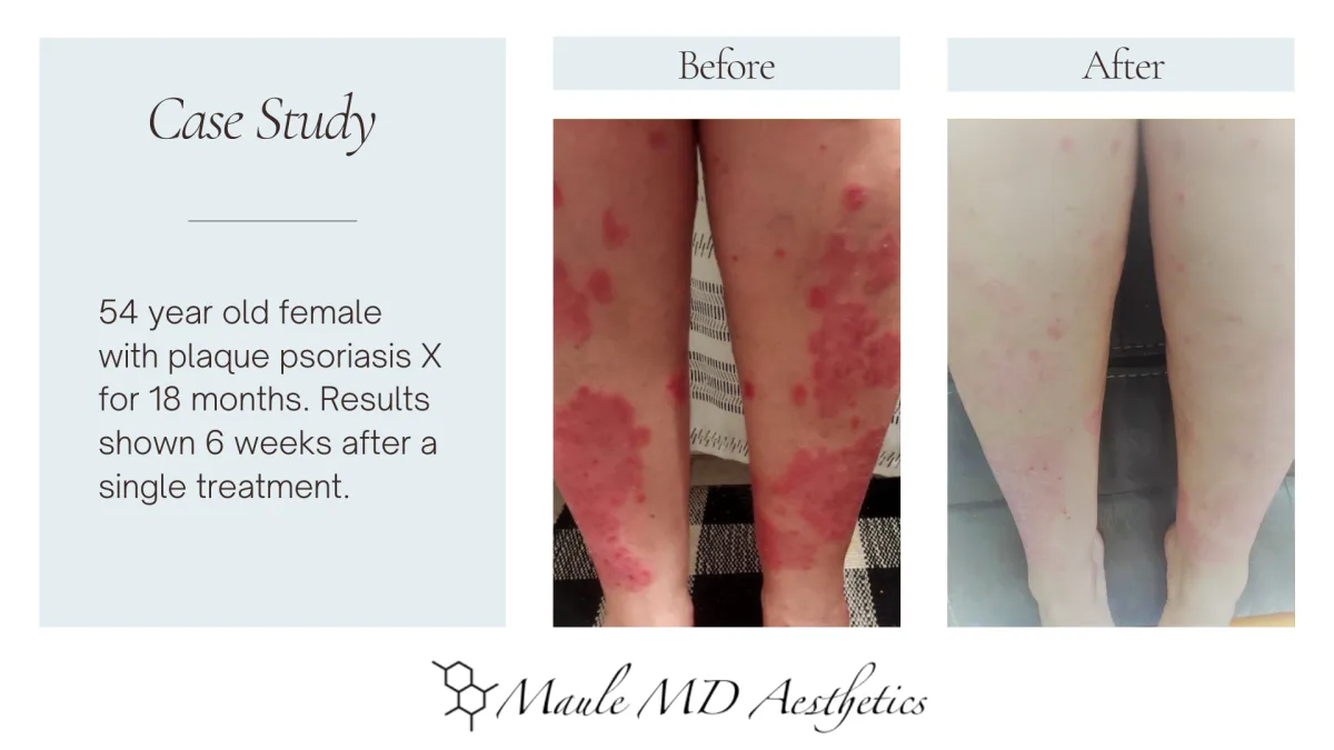 Regenerative Skin Treatment